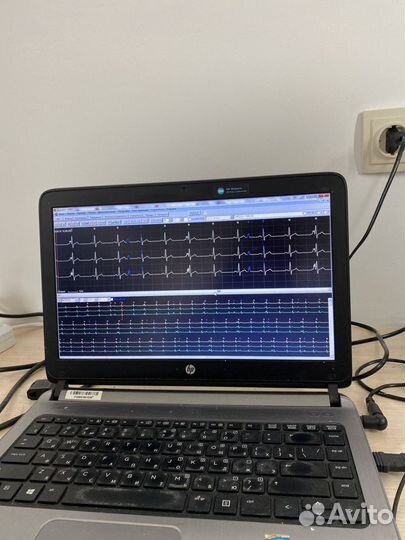 Холтер монитор