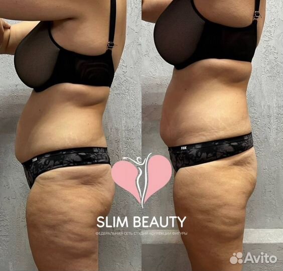 Похудение до 10 кг за курс