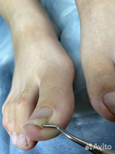 Маникюр педикюр