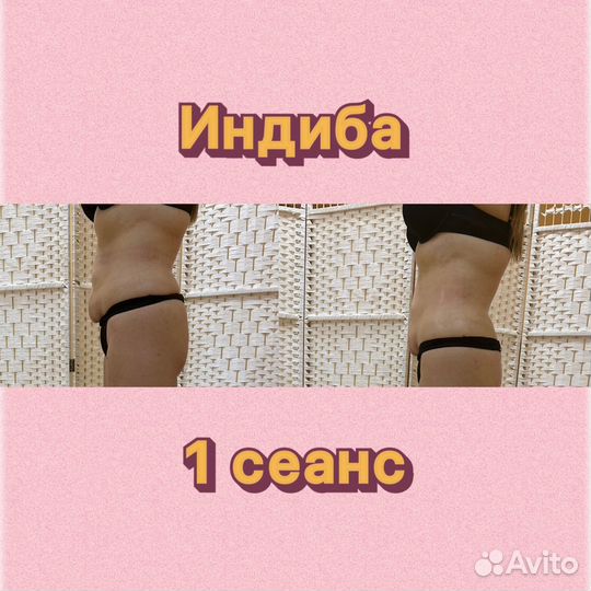 Индиба