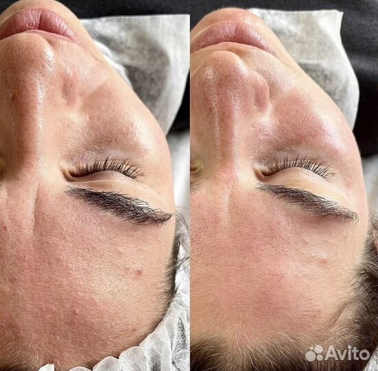 Массаж лица