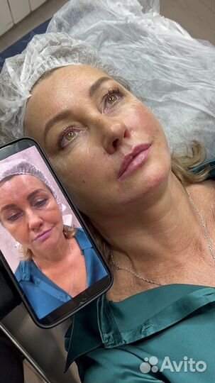Губы, Ботокс Full Face Косметолог Требуются модели