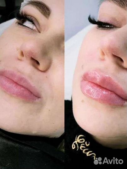 Массаж - (ручная пластика лица )