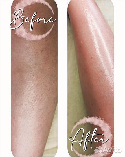 Шугаринг и восковая депиляция