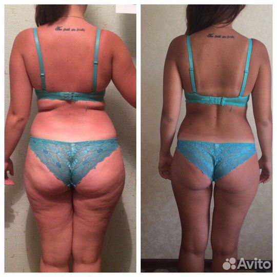 Антицеллюлитный массаж, скульптура тела и лица