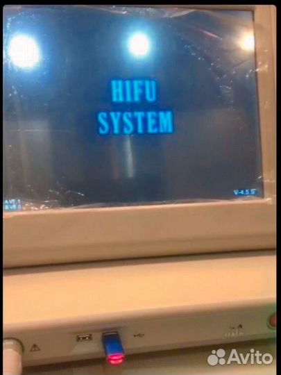 Аппарат для smas-лифтинга Альтера