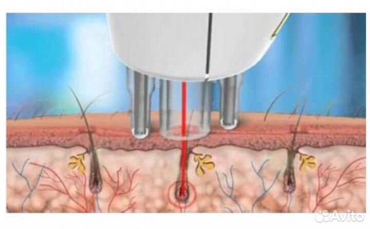 Лазерный эпилятор RIO Salon Laser
