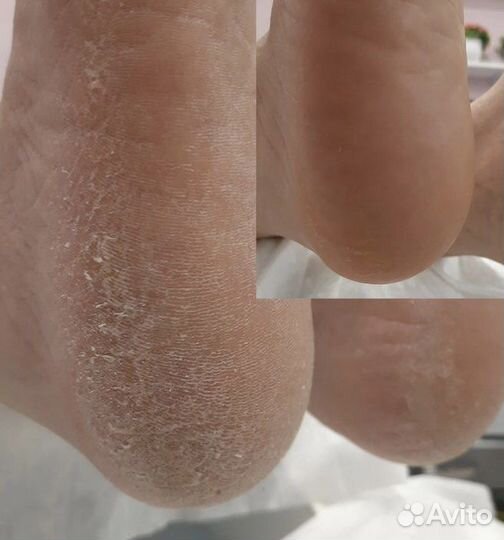 Курс по маникюру обучение по педикюру