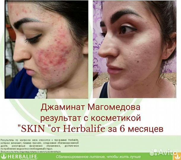 Консультант по питанию