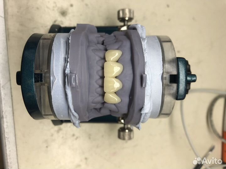 3D моделирование в программах exocad, 3Shape