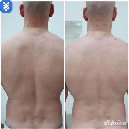 Массаж мануальный костоправ