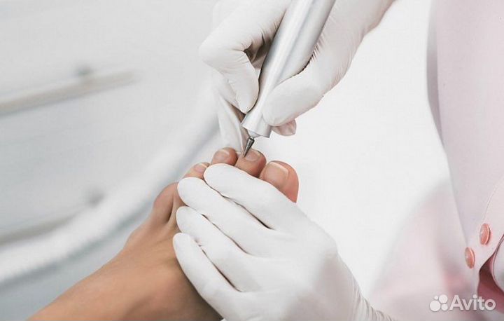 Медицинский педикюр, подолог