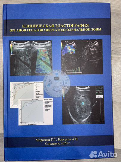 Клиническая эластография