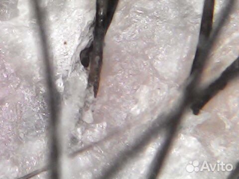 Пилинг для кожи головы