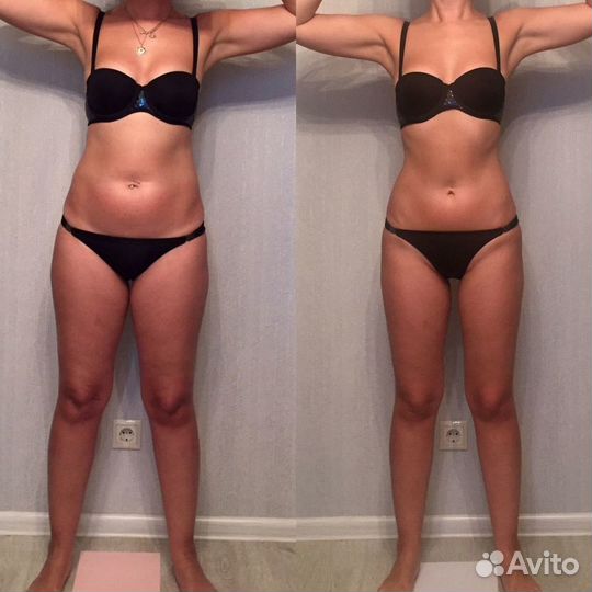 Абонемент на антицеллюлитнай массаж