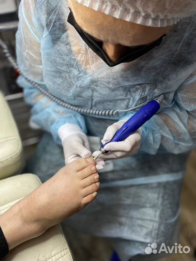 Услуги подолога.Педикюр женский и мужской