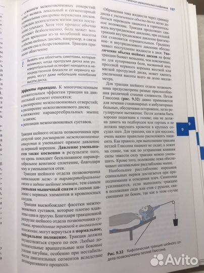 Заболевания межпозвоночных дисков