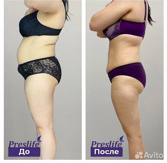 Ищем моделей на подтяжку животика