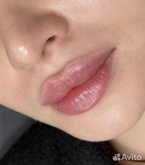 Увеличение губ