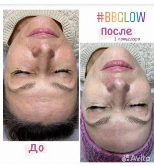 Обучение косметологии без медицинского обр-Ия