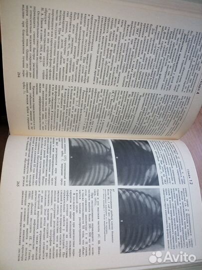 Кардиология детского возраста. Мощича 1986г