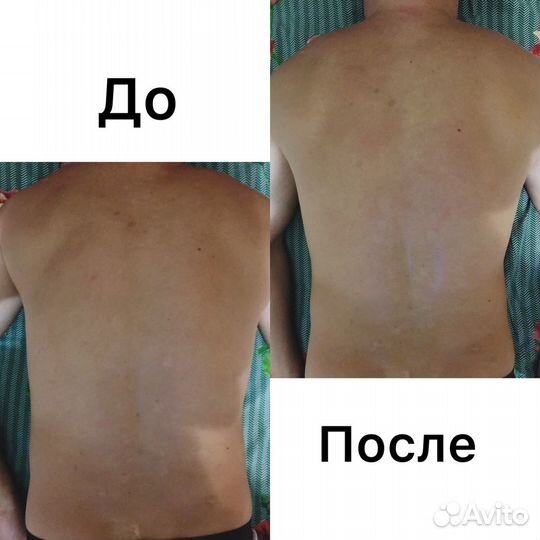 Костоправ