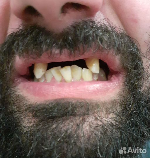 Зубной техник съемное протезирование