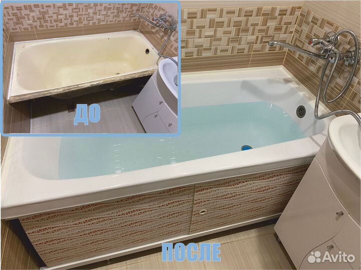 Акриловый вкладыш 