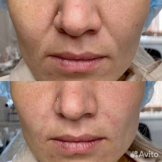 Косметолог с дипломом Архара 6 июля