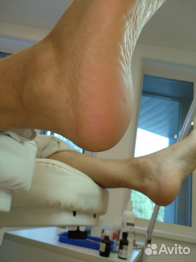 Педикюр с элементами подологии