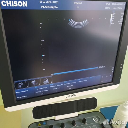 Узи аппарат Qbit8 Chison