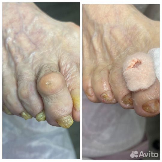 Маникюр,педикюр, подолог с выездом