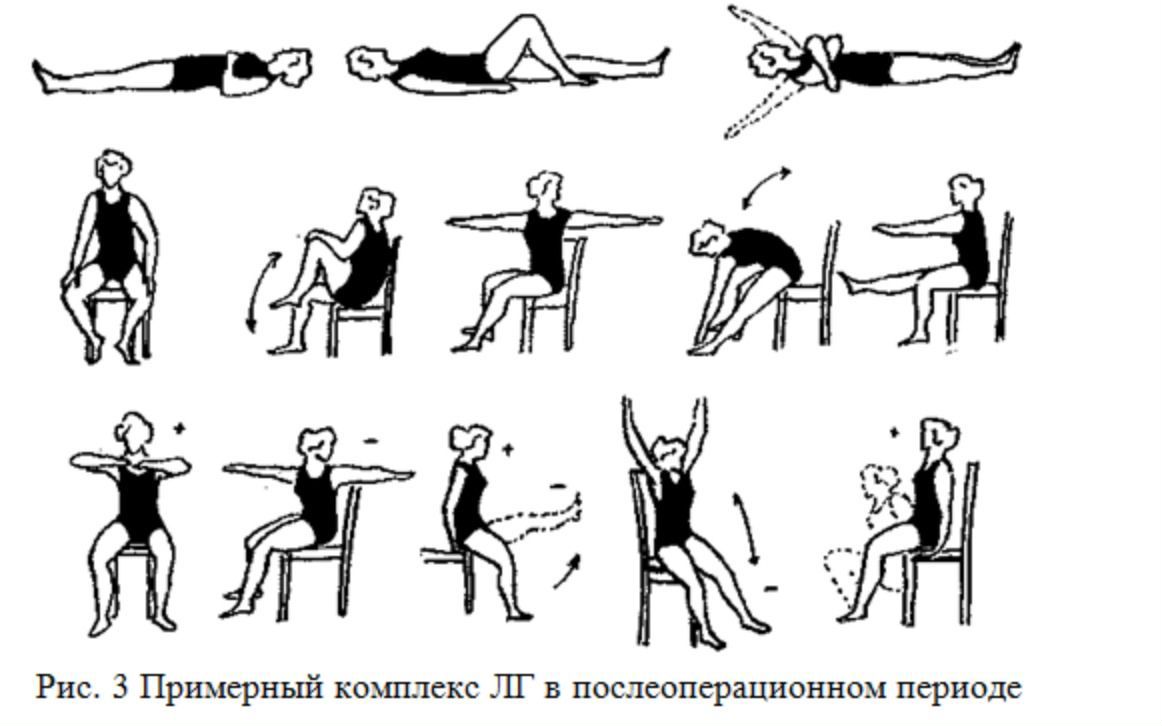 Плеврит гимнастика