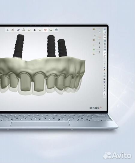 3shape unite 2023 все модули / Dolphin 11.5 - 12