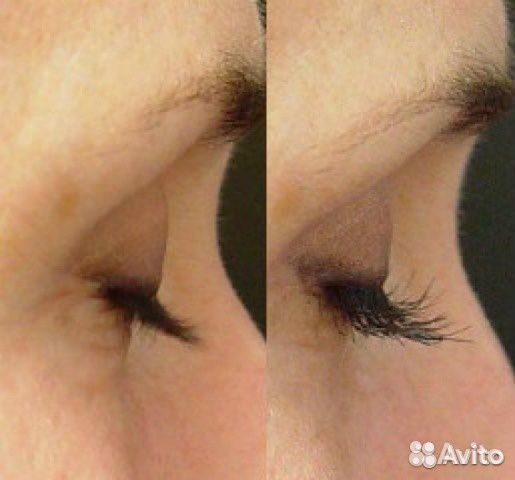 Средство для роста ресниц и бровей карепрост