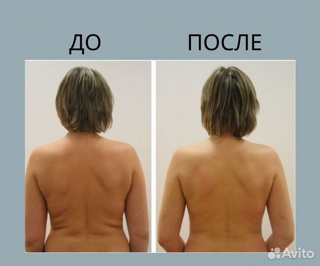 Массаж на дому