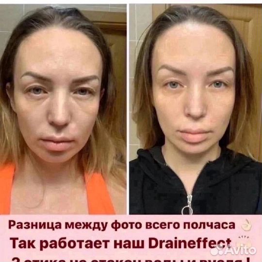 Драйнэффект