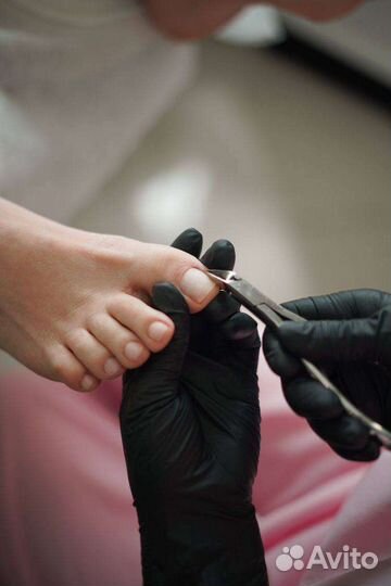 Педикюр / мозоли / вросшие ногти / трешины