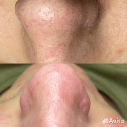 Услуги косметолога