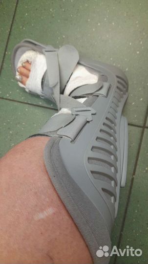 Лангетка на ногу