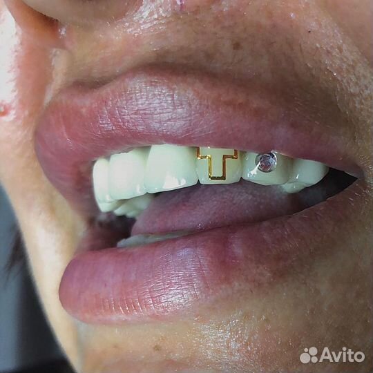 Скайсы/денттату/клыки