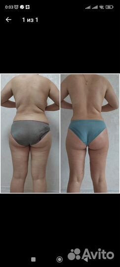 Массаж на дому и с выездом к вам