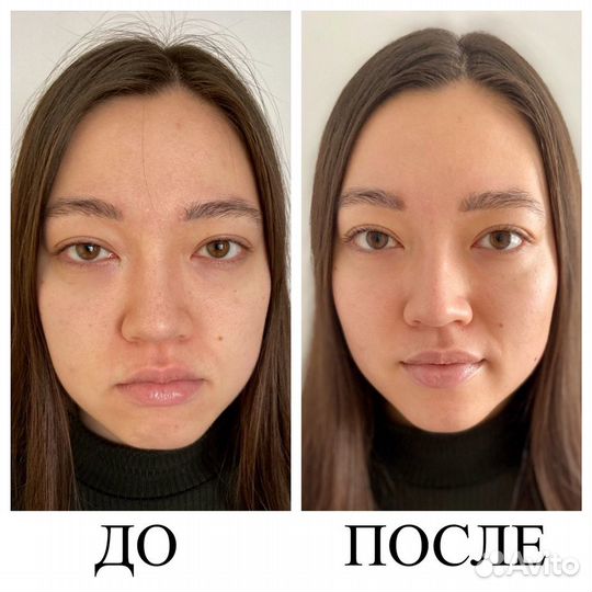 Лечебный массаж