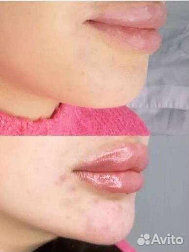 Массаж - (ручная пластика лица )