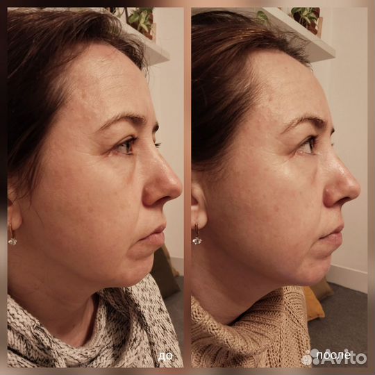 Массаж лица, косметология Мурино /Девяткино/ Бугры