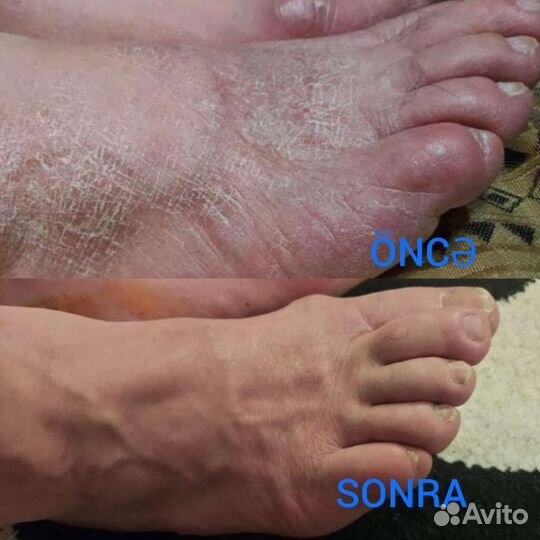 Сибирское здоровье