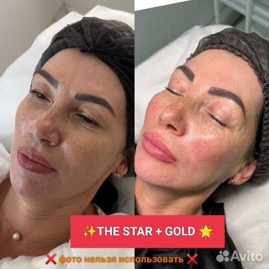 Косметолог- Королевский коктейль Монако