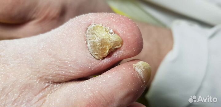 Подолог, педикюр, маникюр