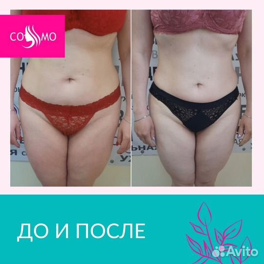 Ищем моделей на коррекцию фигуры