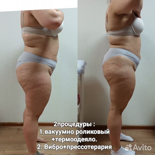 Вибро,вакуумный,вакуумно роликовый массаж